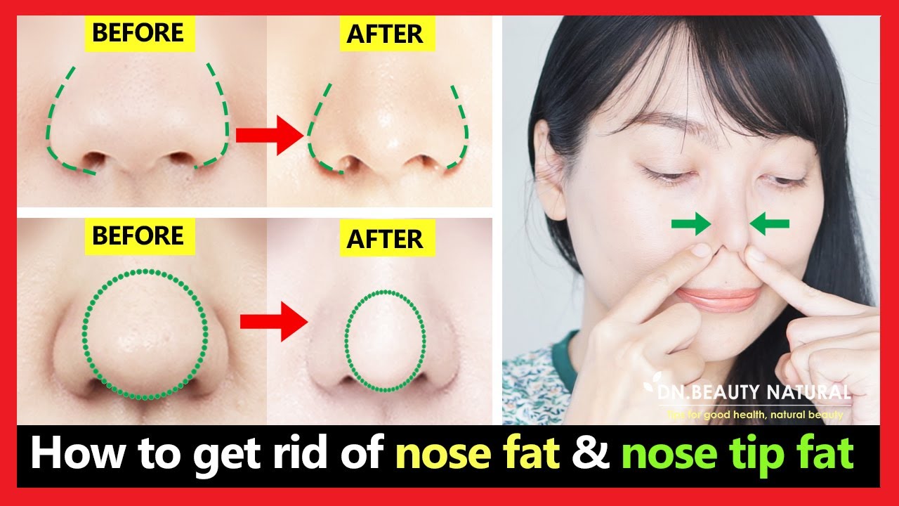 4 Best exercises! Get rid of nose fat, nose tip fat, bulbous nose tip, slim down fat nose naturally.