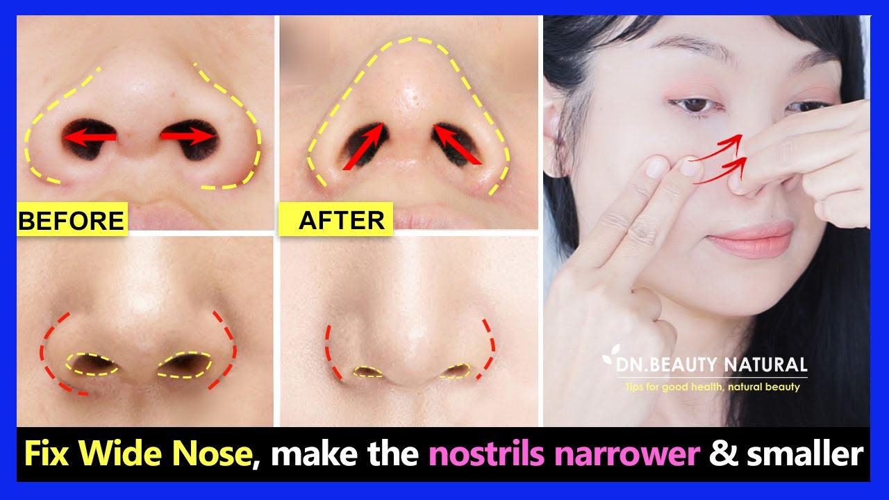 Fix wide nose without surgery, make the nostrils narrower and smaller, the nose tip to point up.