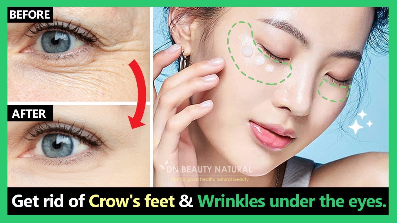 Stop Aging!! Get rid of deep crow’s feet & wrinkles under the eyes by Korean massage & exercises.