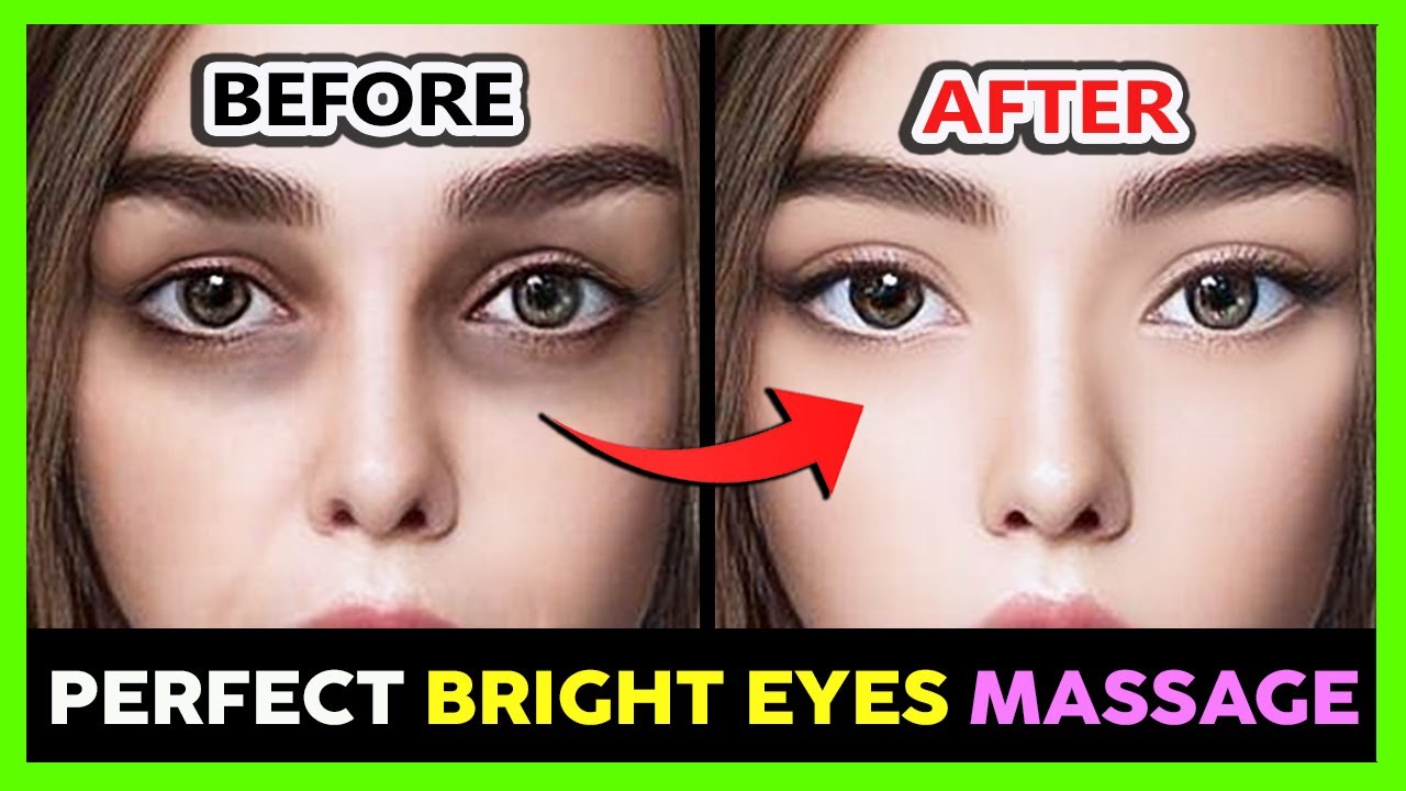 PERFECT BRIGHT EYE MASSAGE | Remove Dark Circles, Sunken Eyes, Hollow eyes, Bags under eyes