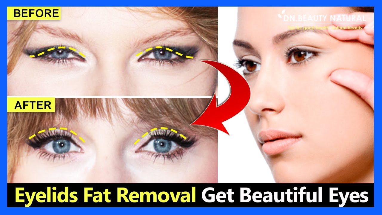 Eyelids Fat Removal Exercises | Get Bigger Eyes, Beautiful Double Eyelids, Fix Droopy Eyelids