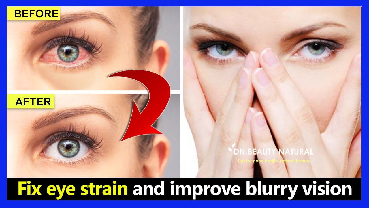 Best Eye Exercises | How to Fix Digital Eye Strain, Dry eyes and Improve Blurry vision naturally