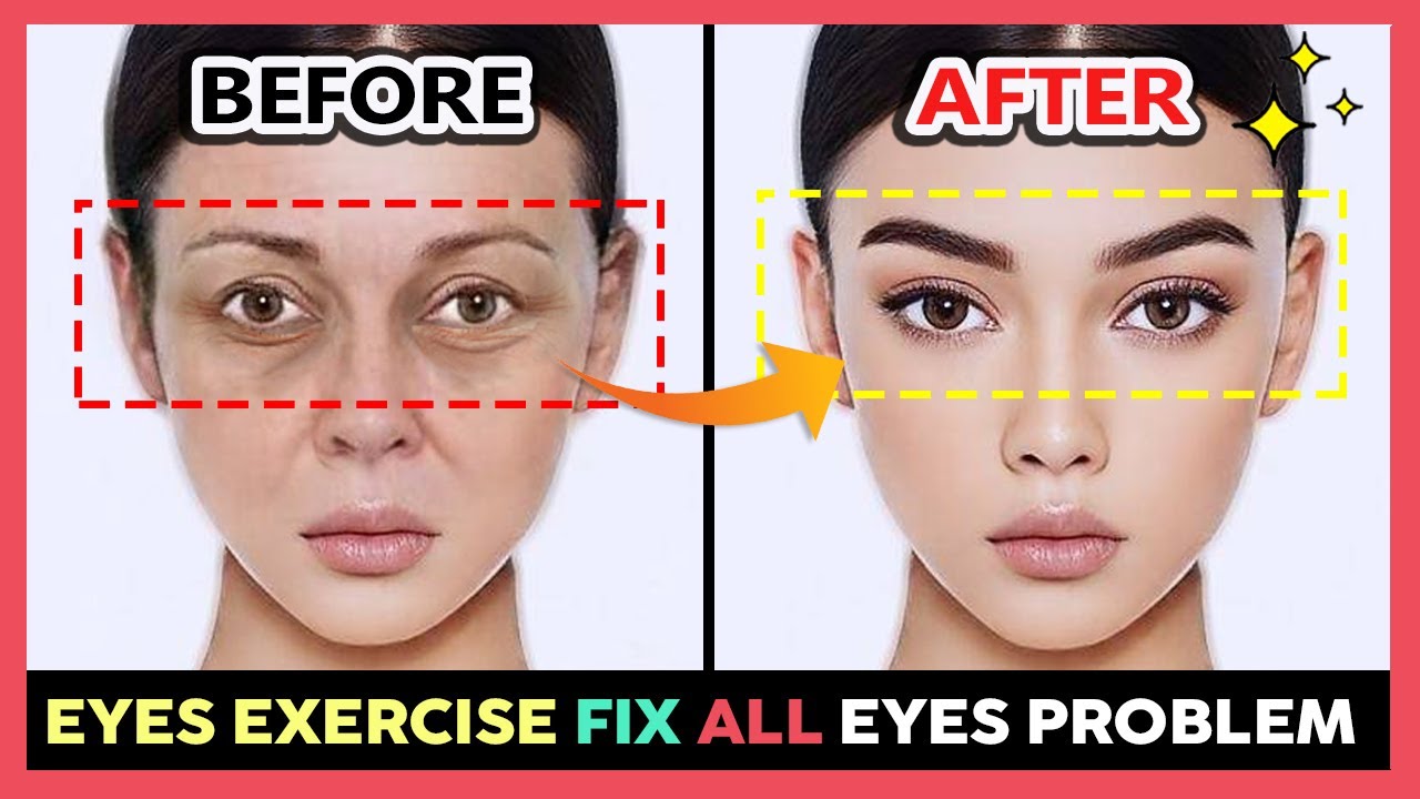 EYES EXERCISE to Reduce dark circles, Wrinkles, Bags under the eyes, Tear Troughs, Droopy eyelids