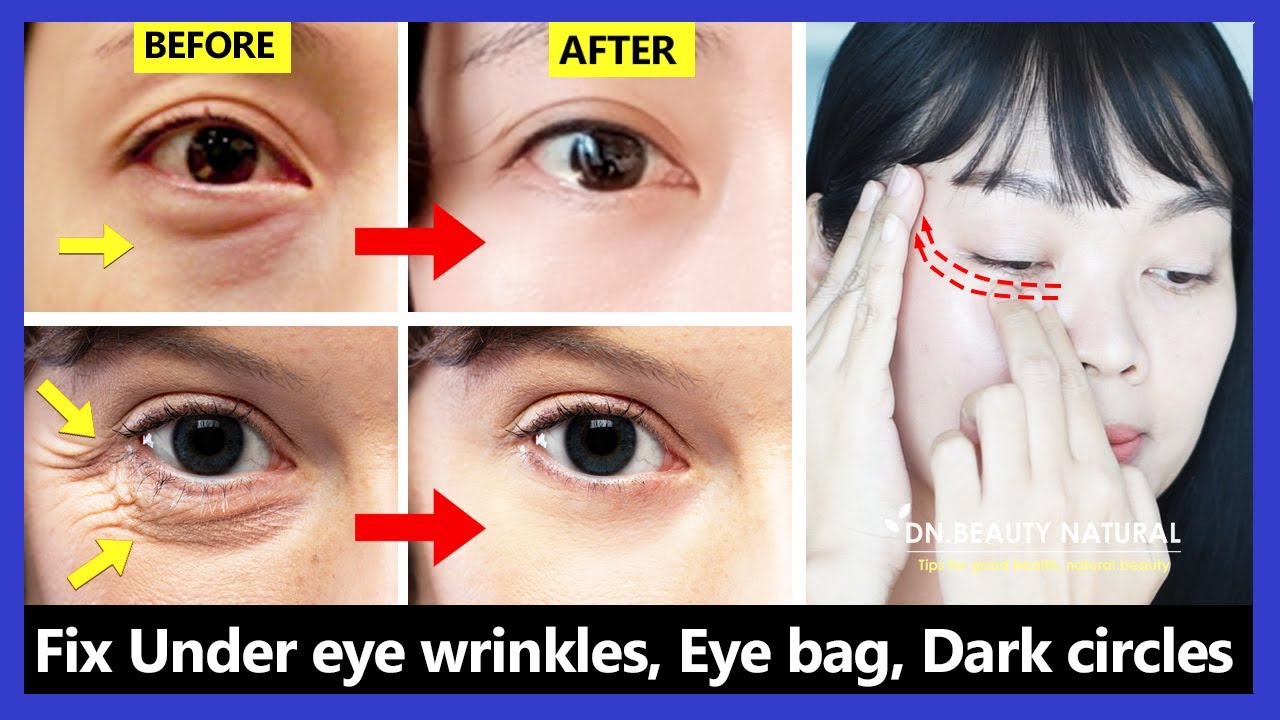 Only 6 mins!! Eye rejuvenation. Get rid of under eye wrinkles, dark circles, eye bags, Crow’s feet