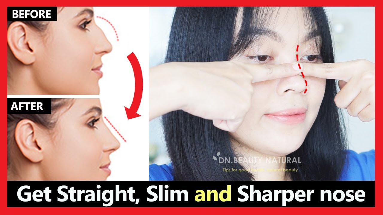 Get rid of hook nose & nose hump reduction naturally | Get Straight, Slim & Sharper nose | Exercises