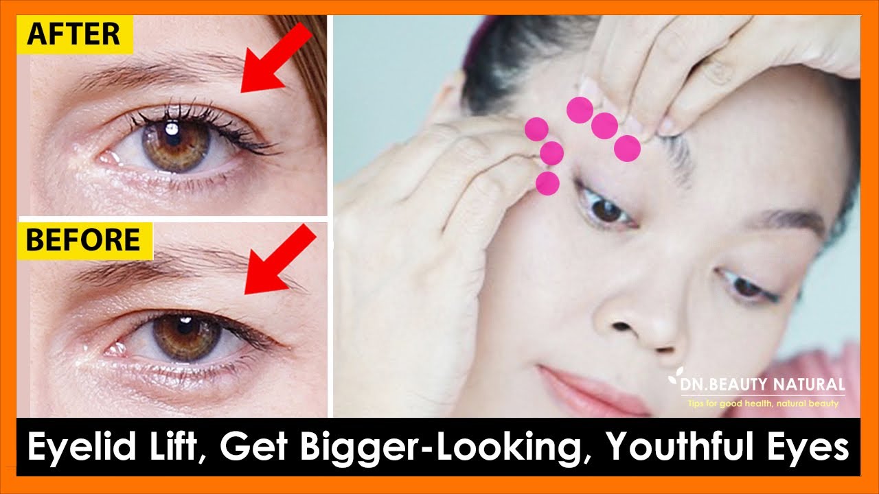 Eyelids Sagging Exercises & Massage to Get Bigger Looking, Youthful Eyes, Tighten droopy eyelids.