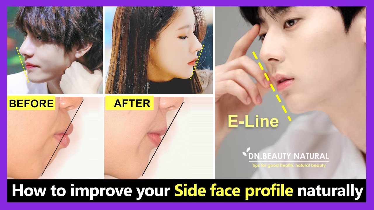 How to improve your side face profile, get a better side face profile naturally without surgery